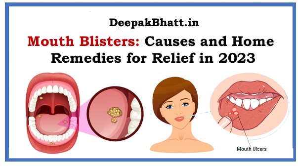 Mouth Blisters Causes and Home Remedies for Relief